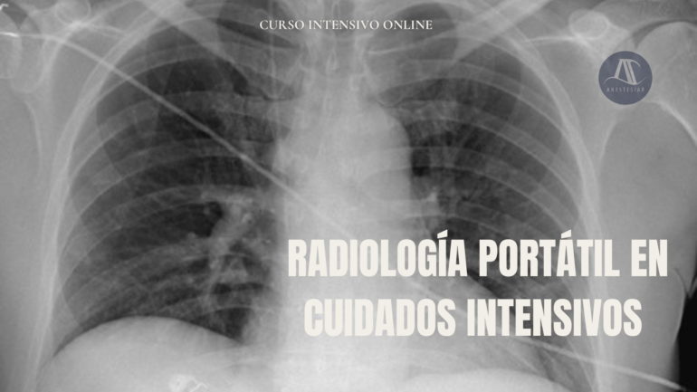 Curso de radiología portátil en el paciente crítico